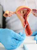 Hysterectomy