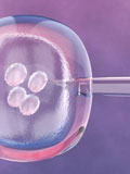 IUI