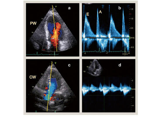 Echocardiography and Colour Doppler Facility Hospital in Saharanpur