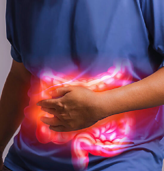 Hernia Repair
