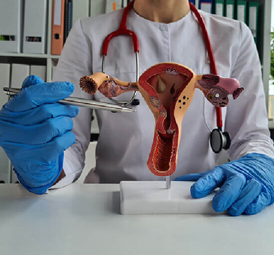 Why is it important to treat PCOS?