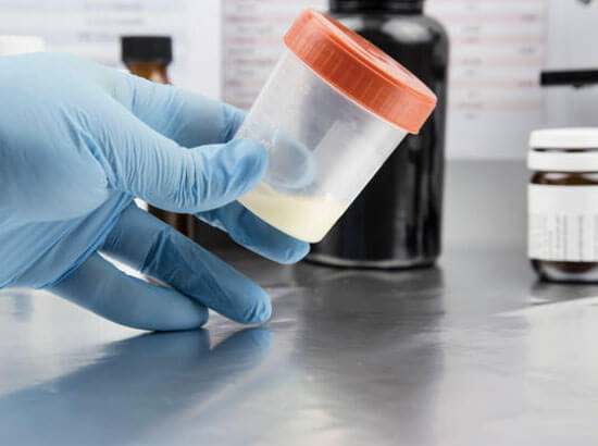 Husband Semen Analysis
